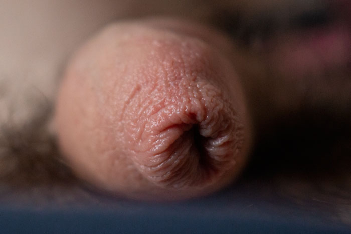 Macro shot of a penile rigged band on a blurred background